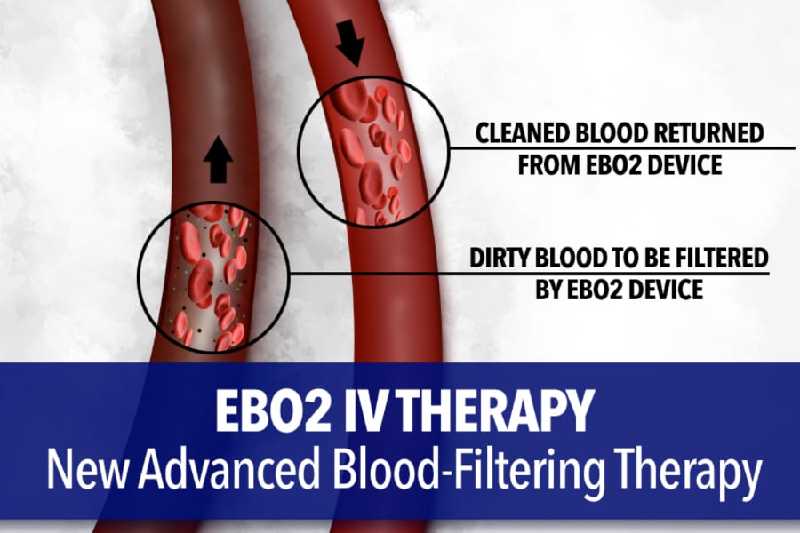 EBO2 IV Therapy New Advanced Blood-Filtering Therapy - showing dirty blood going to be filtered and clean blood returned from EBO2 device.