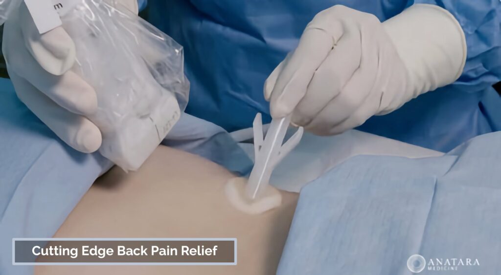 low back pain treatment options